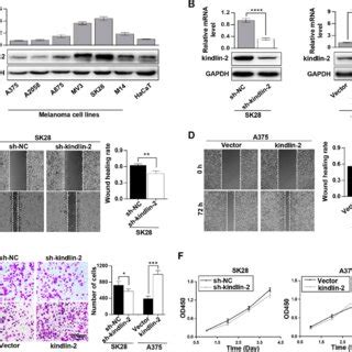 Elevated Kindlin Promotes Melanoma Cell Invasion And Migration A