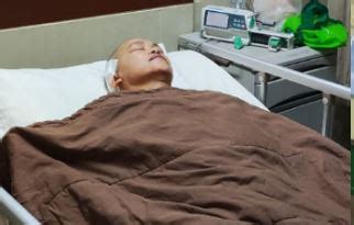 Kepala Pasien Sudah Telanjur Dibor Operasi Angkat Tumor Otak Batal