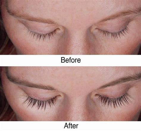 Castor Oil Eyelashes Before After