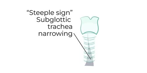 Nurse Practitioner Np Glossary Croup For Np Ditki Medical