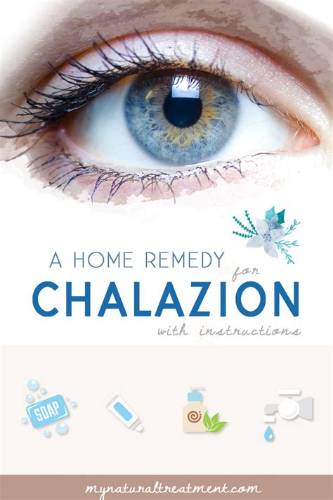 Home Remedy For Chalazion That Works 2 Ingredients