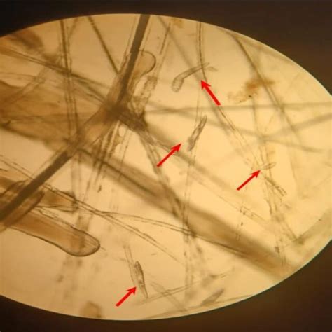 Visualização Do ácaro Demodex Canis Em Lâmina Por Microscópio óptico