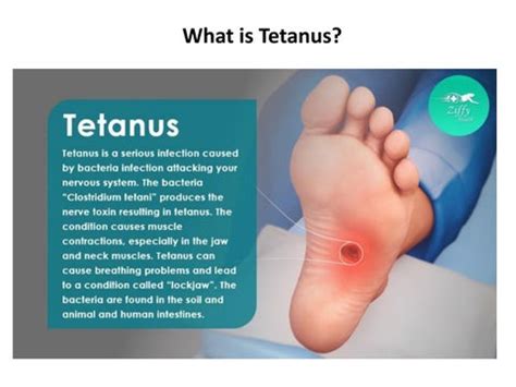 Tetanus Causes Symptoms Prevention Treatment And Complications