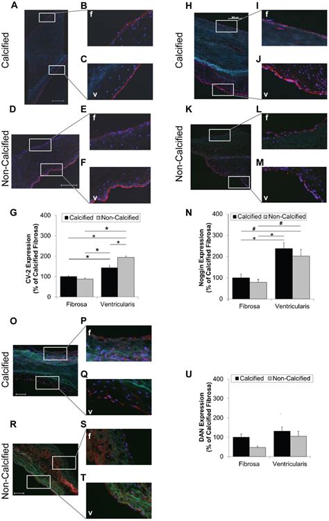 Bmp Antagonist Expression In The Fibrosa And Ventricularis