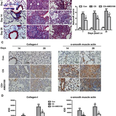 Blockade Cxcr Attenuated Pulmonary Fibrosis In Silicosis Mice A