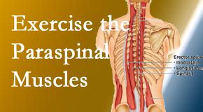 Paraspinal Muscles Matter! | Apple Country Chiropractic