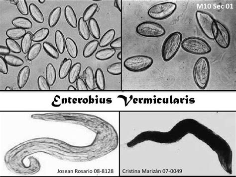 Enterobius Vermicularis 🔬🐛😍 Mikrobiyoloji Microbiology Microbiologia