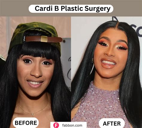 Cardi B Plastic Surgery Full Guide Before And After Photos Fabbon