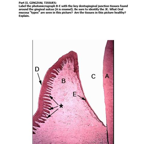 Solved Part Ii Gingival Tissues Label The Photomicrograph Chegg