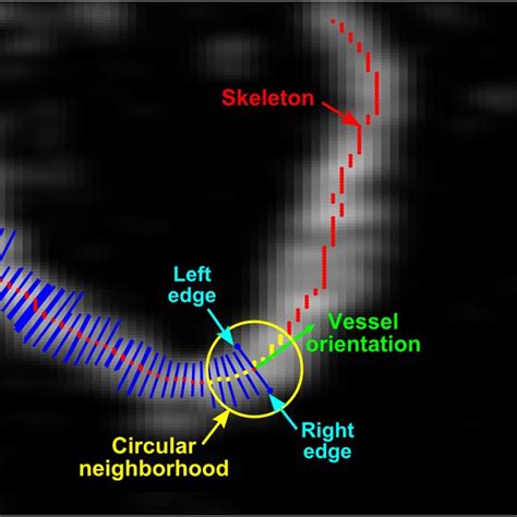 Illustration Of Automatic Quantification Of Blood Vessel Diameter Along