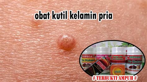 Obat Kutil Kelamin Pria Youtube