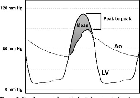 Figure 11 From Hemodynamics In The Cardiac Catheterization Laboratory Of The 21st Century