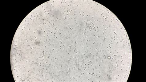 View At Human Sperm Under Microscope In Lab Stock Video Video Of Dish