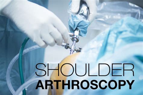 Shoulder Arthroscopy Symptoms Causes Treatment By Shoulder Braces