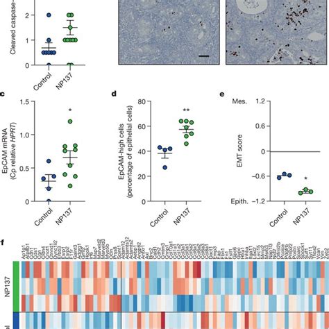 Netrin Blockade Inhibits Endometrial Adenocarcinoma Progression In