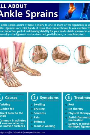 Infographics Foot Ankle Specialty Group