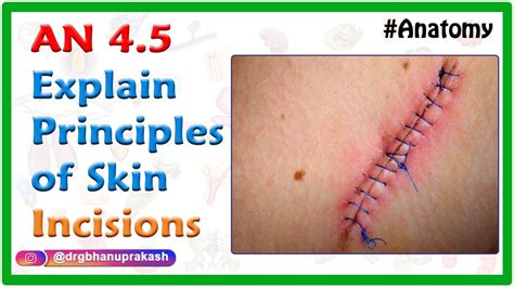 Explain Principles Of Skin Incisions National Exit Test Based On