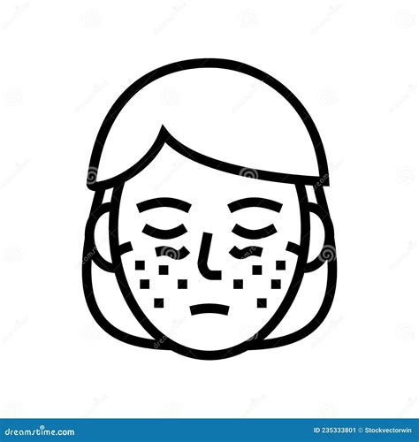 Systemic Lupus Erythematosus Line Icon Vector Illustration Stock Vector