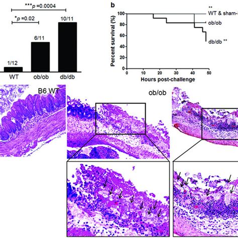 A Mice Genetically Deficient In Leptin Ob Ob And In Functional