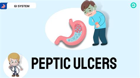 Peptic Ulcer Disease Everything You Need To Know YouTube