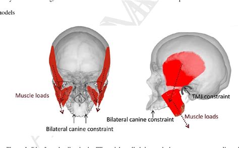 Figure From Structural Biomechanics Of The Craniomaxillofacial