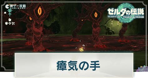 【ティアキン】瘴気の手の倒し方と出現場所【ゼルダの伝説ティアーズオブザキングダム】 神ゲー攻略