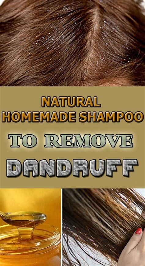 Natural Homemade Shampoo To Remove Dandruff Howtoremovedandruff Homemade Natural Shampoo