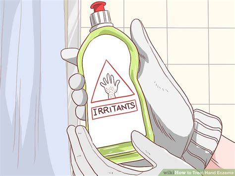 3 Ways To Treat Hand Eczema Wikihow