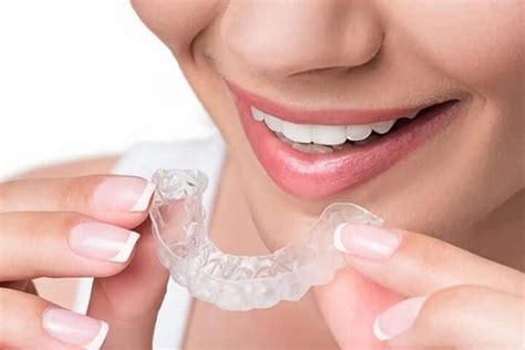 Invisalign Express Ortodoncia Invisible Y Su Precio Ferrus Bratos