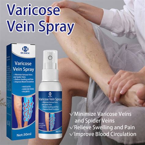 Varicose Vein Massage Spray Vein Remover Varicose Veins Treatment Vasculitis Angiitis Remedy