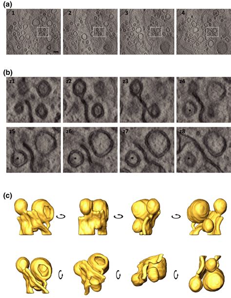 Ultrastructural Analysis Of E Derm Infected Cells At Hr Pi Using