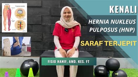 Kenali Hernia Nukleus Pulposus Hnp Saraf Terjepit Youtube