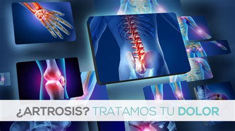 Fisioterapia Traumatologo Vigo Tratamiento Artrosis ICONICA Servicios