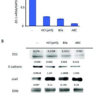 Tj Gene Expressions In Ana And Aa A In A Comprehensive Analysis Of