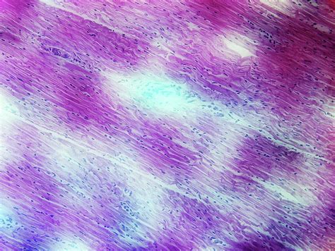 Cardiac Muscle Photograph By John Griffin University Of Queensland