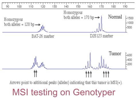 Microsatellite Instability Msi