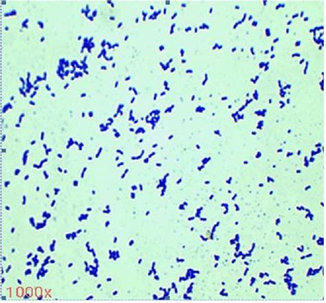 Gram Positive Rods