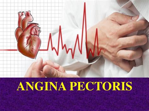 Solution Cardiovascular Angina Pectoris Studypool