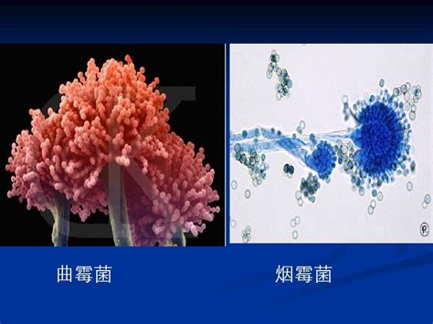 肺部真菌病诊断和治疗专家共识word文档在线阅读与下载无忧文档