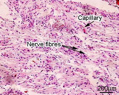 Pituitary: Pituitary Histology