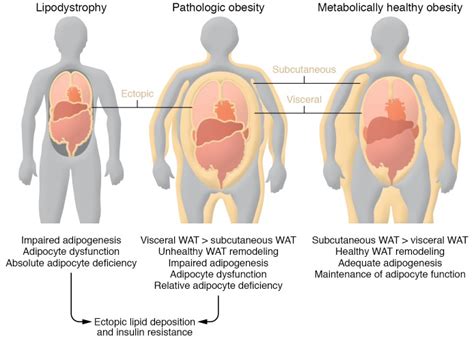 Contribution Of Adipogenesis To Healthy Adipose Tissue Expansion In Obesity Abstract Europe Pmc