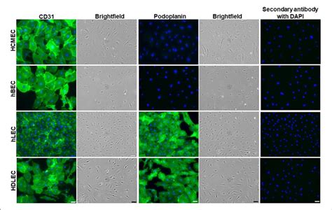 Plated Cell Types Human Cardiac Microvascular Endothelial Cells