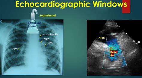 Basic Echocardiographic Views