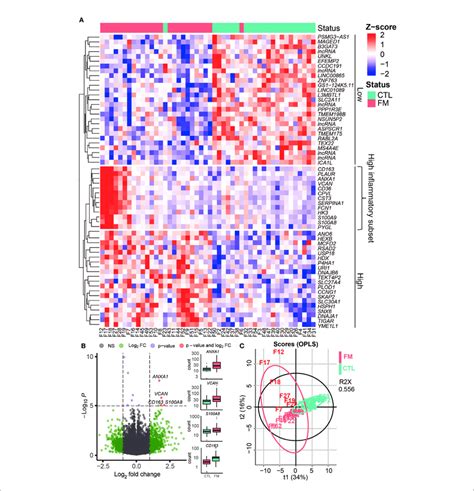 Gene Expression Profile In B Cells Of Fm Patients Compared To