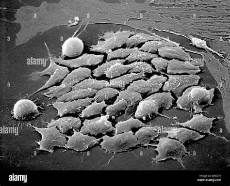 Elektronenmikroskop zelle Schwarzweiß Stockfotos und bilder Alamy