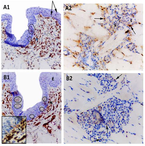 A Photomicrograph Of Circumvallate Papillae Immunostained With S100 At