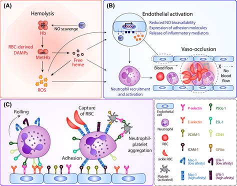 Current Paradigm Of Vasoocclusion In Sickle Cell Disease A