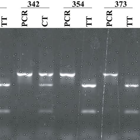 Restriction Enzyme Digestion Pattern Of HSP70hom 2437