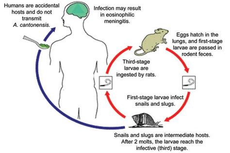 What Is Rat Lungworm Disease, the Disease that Killed This Australian Teen?