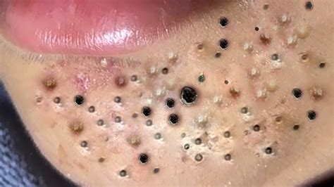 𝐀 𝐖𝐨𝐧𝐝𝐞𝐫𝐟𝐮𝐥 𝐃𝐚𝐲 # 3015 - YouTube 